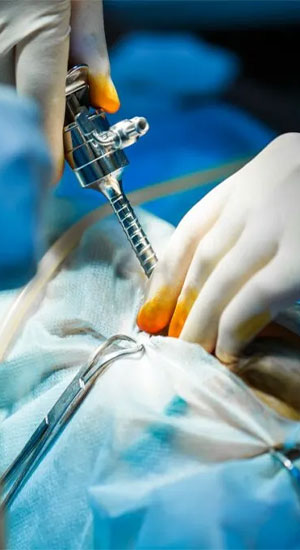 Surgical & Advanced Procedures